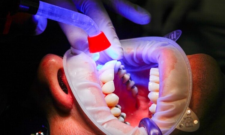 Descubre los beneficios de la estética dental