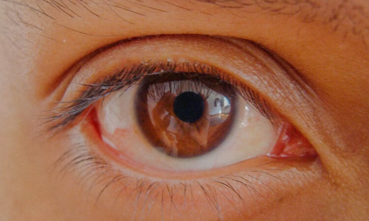 Ver bien sin gafas: lo que nadie te cuenta sobre decir adiós a la miopía